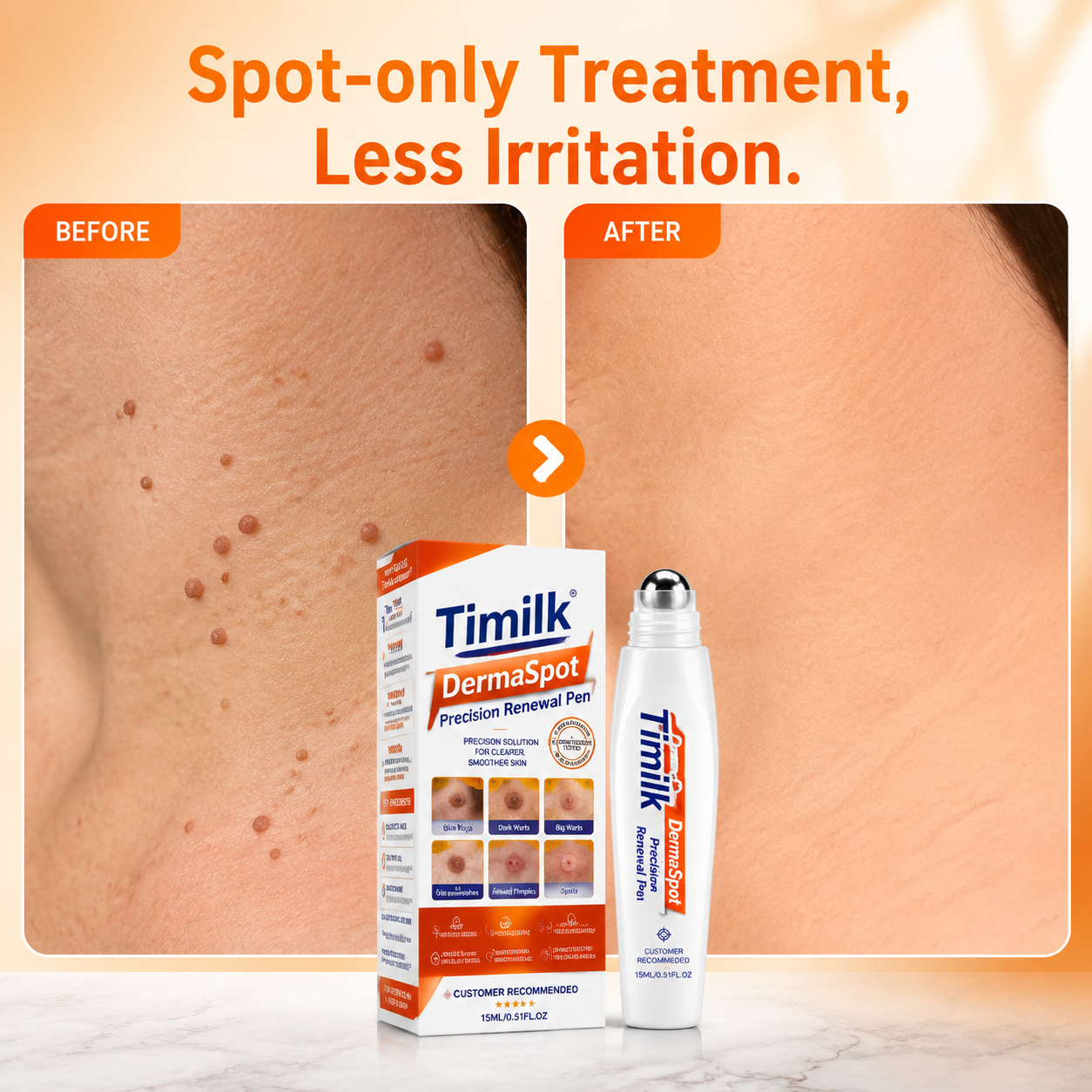 Timilk® DermaSpot Precision Renewal Pen