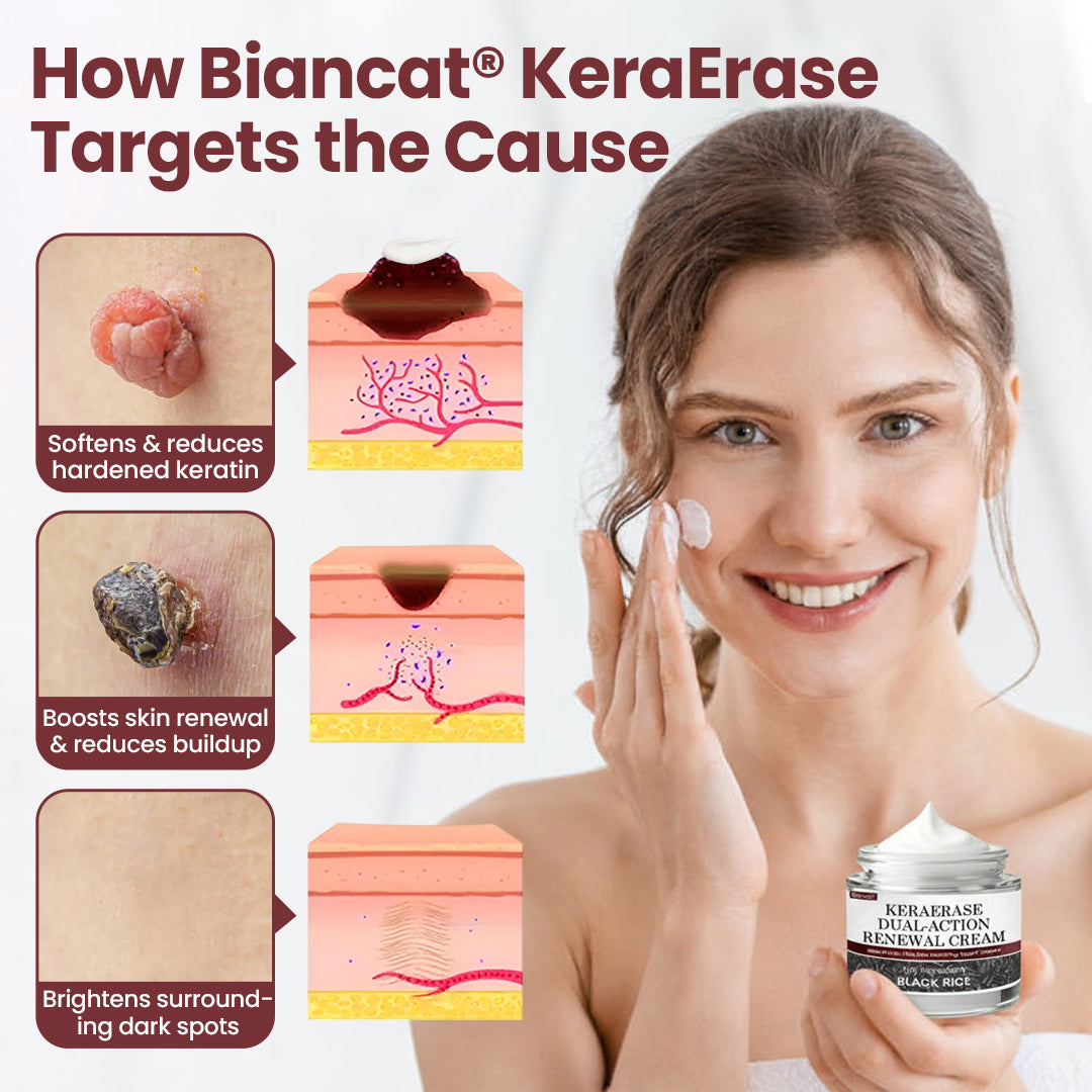 Biancat® KeraErase Dual-Action Renewal Cream 🎂