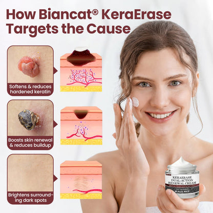 Biancat® KeraErase Dual-Action Renewal Cream 🎂