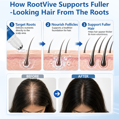Ceoerty® RootVive Hair Growth Serum Roll-On