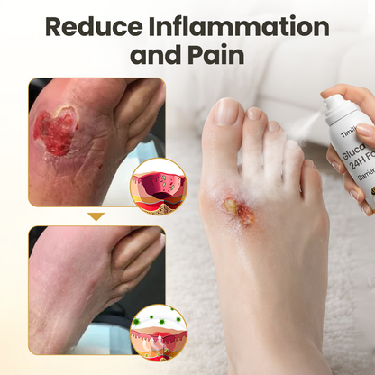 Timilk® GlucaVeil 24H Foot Barrier Spray✨